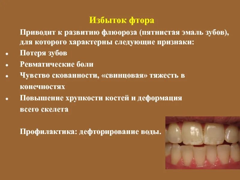 И постоянные изменения приводят к. Системная гипоплазия эмали зубов. Системная гипоплазия эмали зубов у детей. Гипоплазия эмали гипоплазия флюороз.