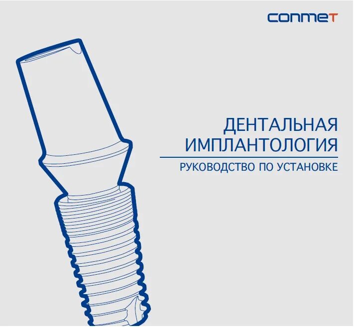 конмет имплантаты