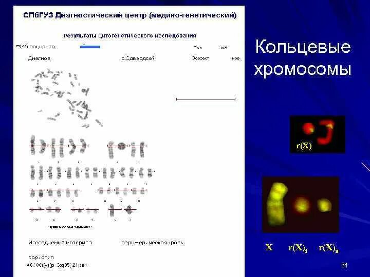 Цитогенетика. Кольцевая хромосома. Кольцевая хромосома у человека. Возникновение кольцевых хромосом.