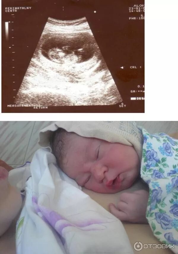 Перинатальный центр сыктывкар пушкина 114. Сыктывкарский перинатальный центр. Коми республиканский перинатальный центр. Перинатальный центр сыктывкар. Сыктывкар перинатальный центр пушкина д 103.