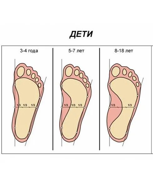 Стопа или ступня как правильно. Плоскостопие. комбинированная плоскостопия. стопа комбинированное плоскостопие. продольное и поперечное плоскостопие.