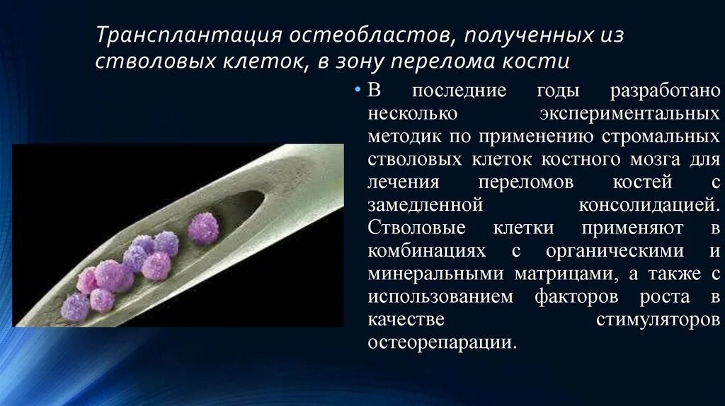 Трансплантация стромальных клеток. Стволовые клетки пересадка. Трансплантация кроветворных стволовых клеток. Стволовые клетки костного мозга.