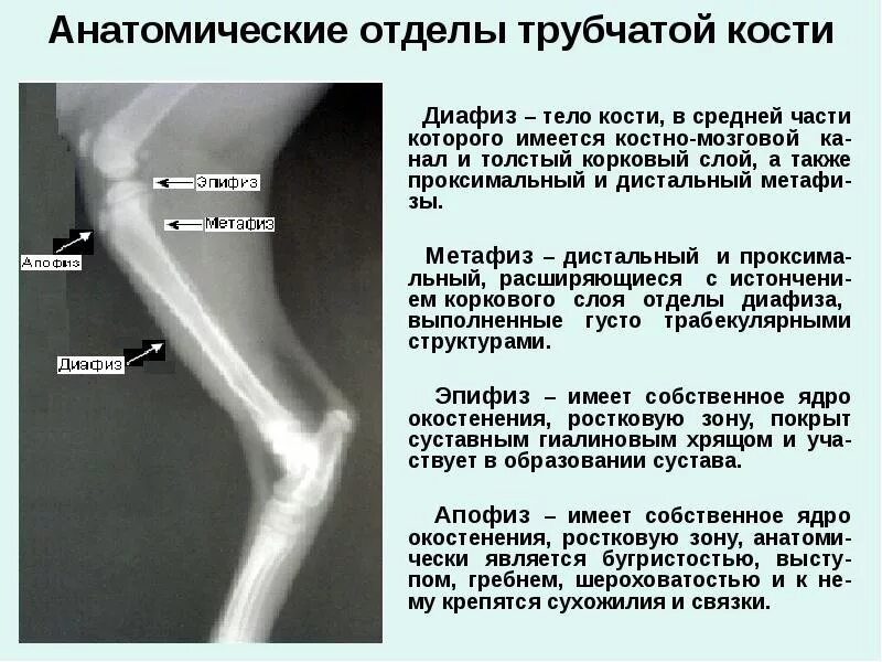 Проксимальный отдел кости это. Диафиза большеберцовой кости. Классификация переломов бедренной кости. 26. Перелом эпифиза бедренной кости.