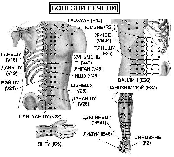 Акупунктурные точки при заболеваниях позвоночника. Точки акупунктуры при боли в пояснице. Иглоукалывание схема. Акупунктурные точки на спине. Версия 3.3 точка