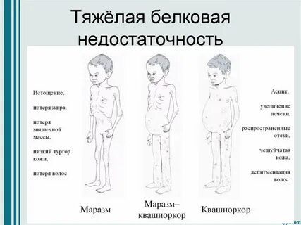 Недостаточность организма
