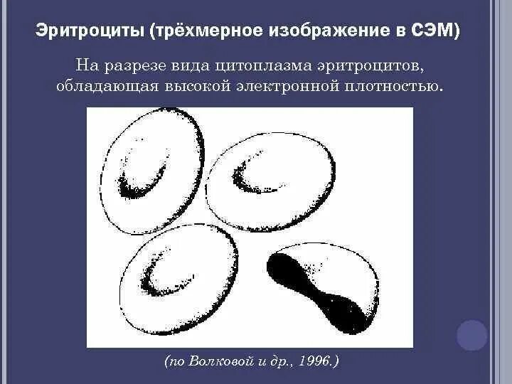 Эритроциты рисунок. Эритроцит в разрезе. Эритроциты схематичный рисунок. Эритроциты гистология. Эритроцит рисунок гистология.