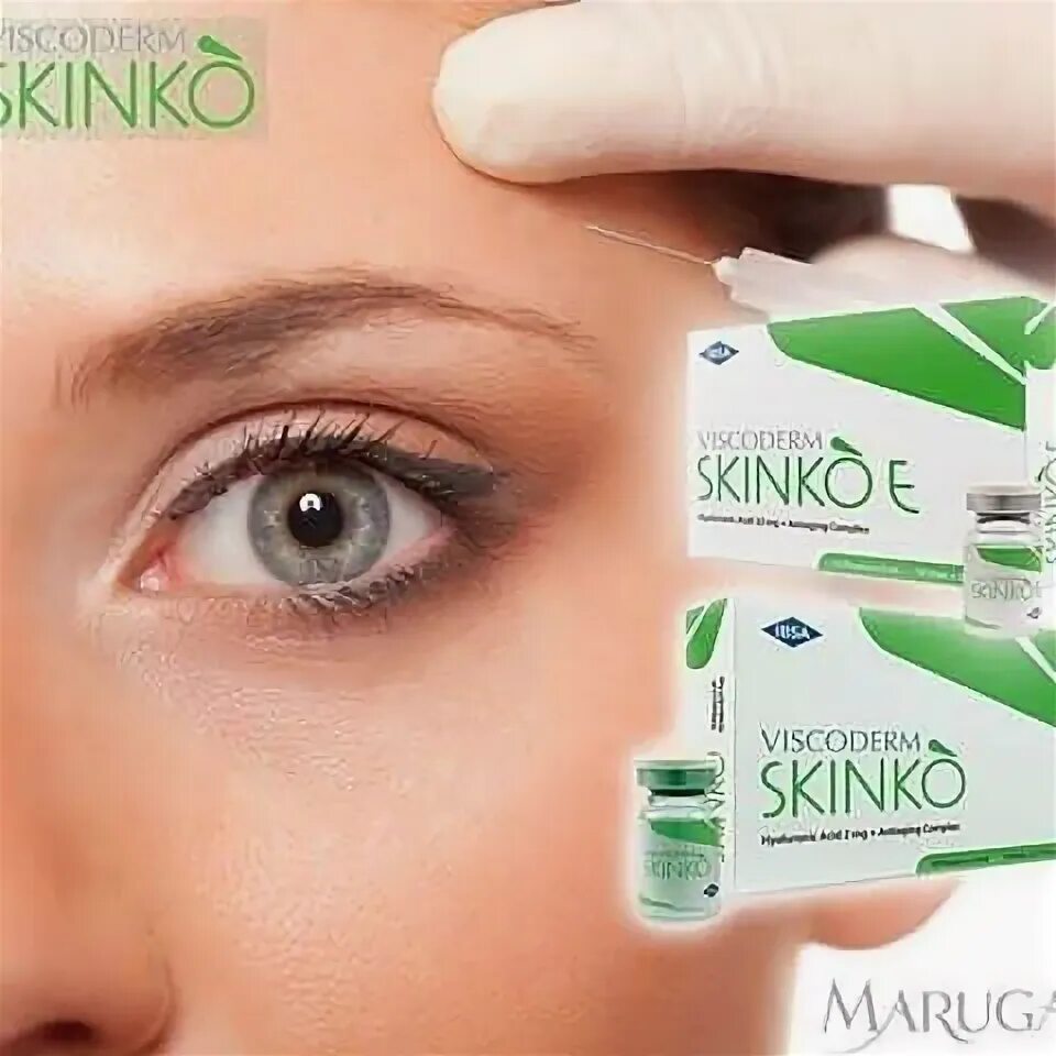Viscoderm skinko. Скинко и скинко е. вискодерм скинко. viscoderm 1.6 биоревитализация. биоревитализация препараты skinko.
