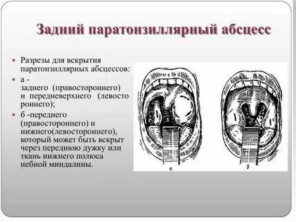 Полость лекарственный