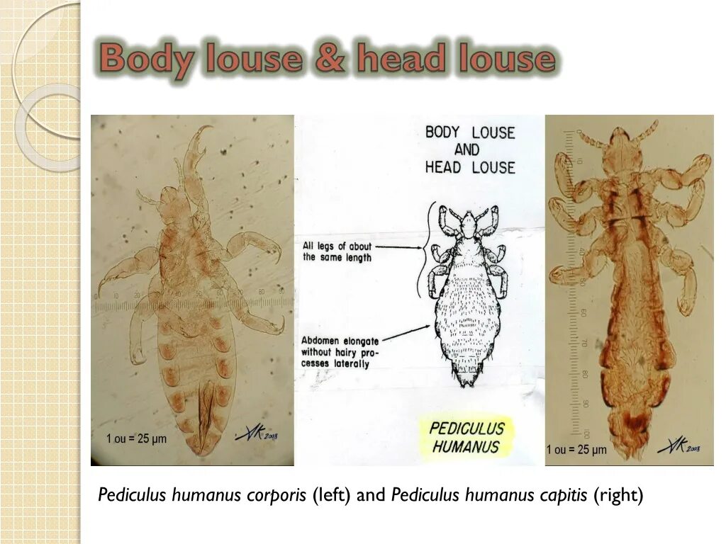 К какому классу относится вошь. Вошь платяная (pediculus humanus humanus. pediculus humanus corporis жизненный цикл. жизненный цикл pediculus humanus capitis. платяная вошь строение.