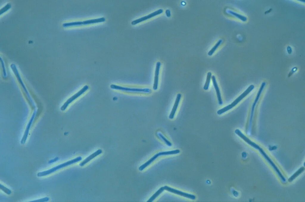 Clostridium spp. Клостридии бутирикум. Clostridium botulinum микроскоп. Клостридия ботулизма.