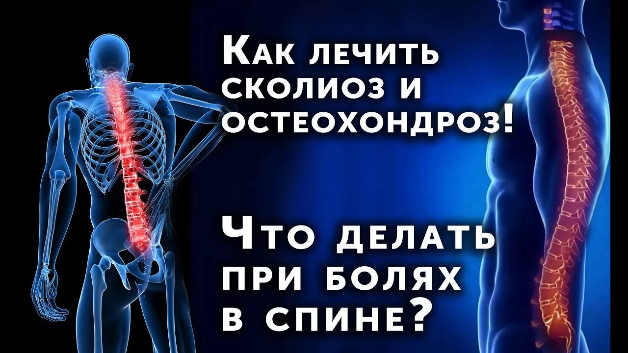 Как лечить спинной. Болит спина. Боль в спине позвоночник. Боль в спине остеохондроз. Что делать при боли в спине.