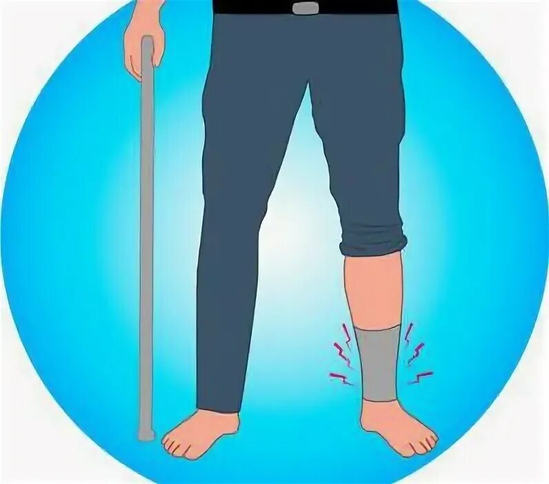 Трость после эндопротезирования. Правильное хождение с тростью. Ходьба с палочкой после перелома ноги. Ходьба с тростью после эндопротезирования тазобедренного сустава. Правильная ходьба с тростью.