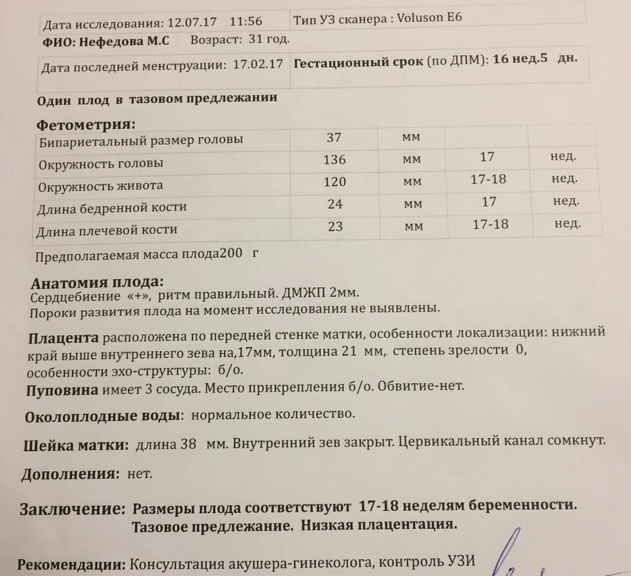 Слишком большая окружность головы плода - Вопрос генетику - 03 Онлайн