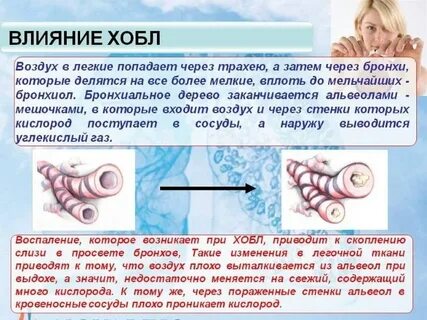 Большое количество кислорода
