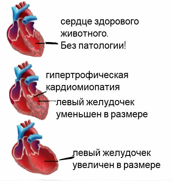 Что такое порок сердца у взрослых. Что такое порок сердца у взрослых