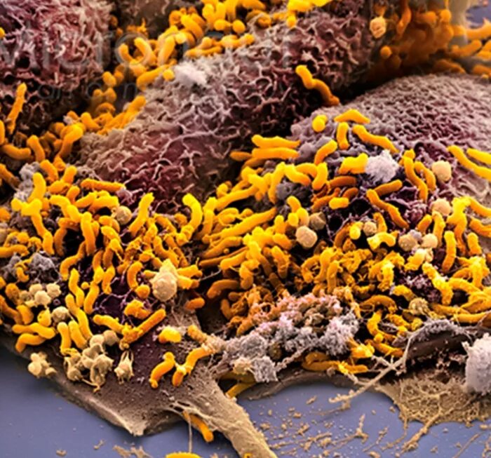 Бактериоскопический метод, Бактериологический метод - Helicobacter pylori - враг