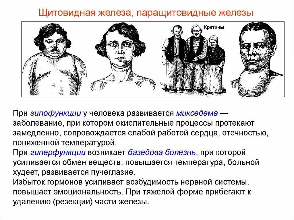 Гипофункция паращитовидных желез вызывает. Паращитовидная железа гипофункция и гиперфункция заболевания. железа внутренней секреции гипофункция щитовидной железы. железа внутренней секреции микседема. паращитовидная железа гипофункция железы.