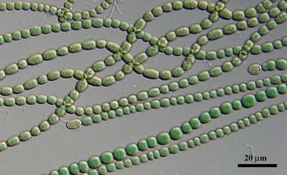 Анабена. Цианобактерии anabaena. цианобактерии anabaena azollae. anabaena водоросль. носток и анабена.
