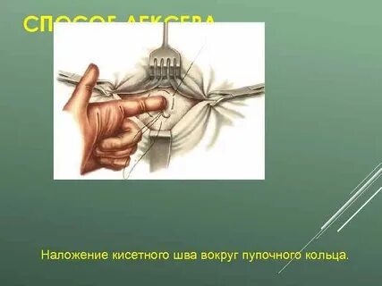 Хирургическое лечение грыж