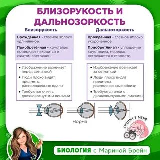 Для миопии характерно