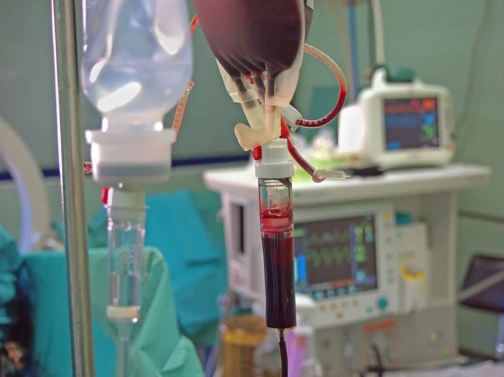 При низком гемоглобине делают операции. Процесс переливания крови. Переливание крови при операции.