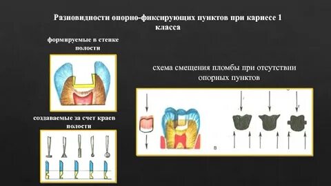 Полость край