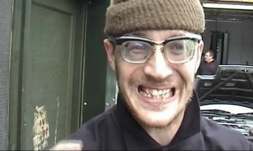 Том харди зубы. Зубы Тома Харди. Том Харди и его зубы. Том Харди зубы фото