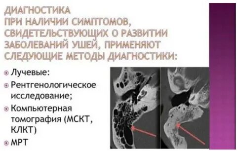 Диагноз уха