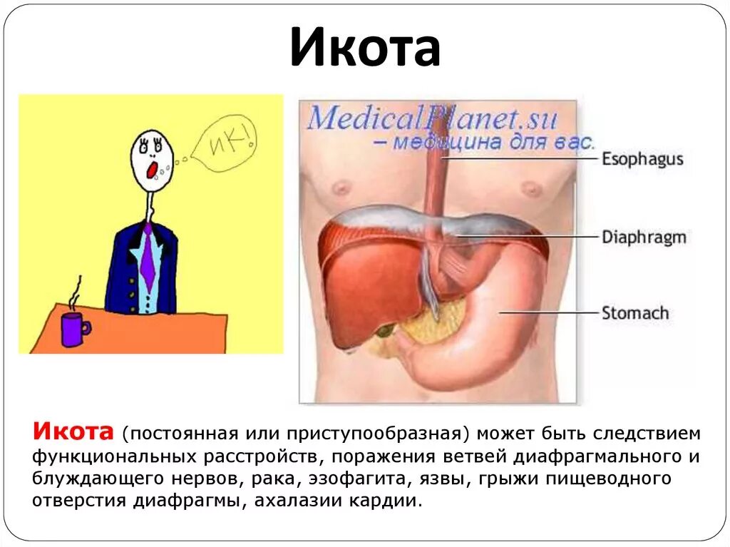 Почему постоянно икаешь. Икота. Икота при заболевании. Икота у человека. Патогенез икоты.