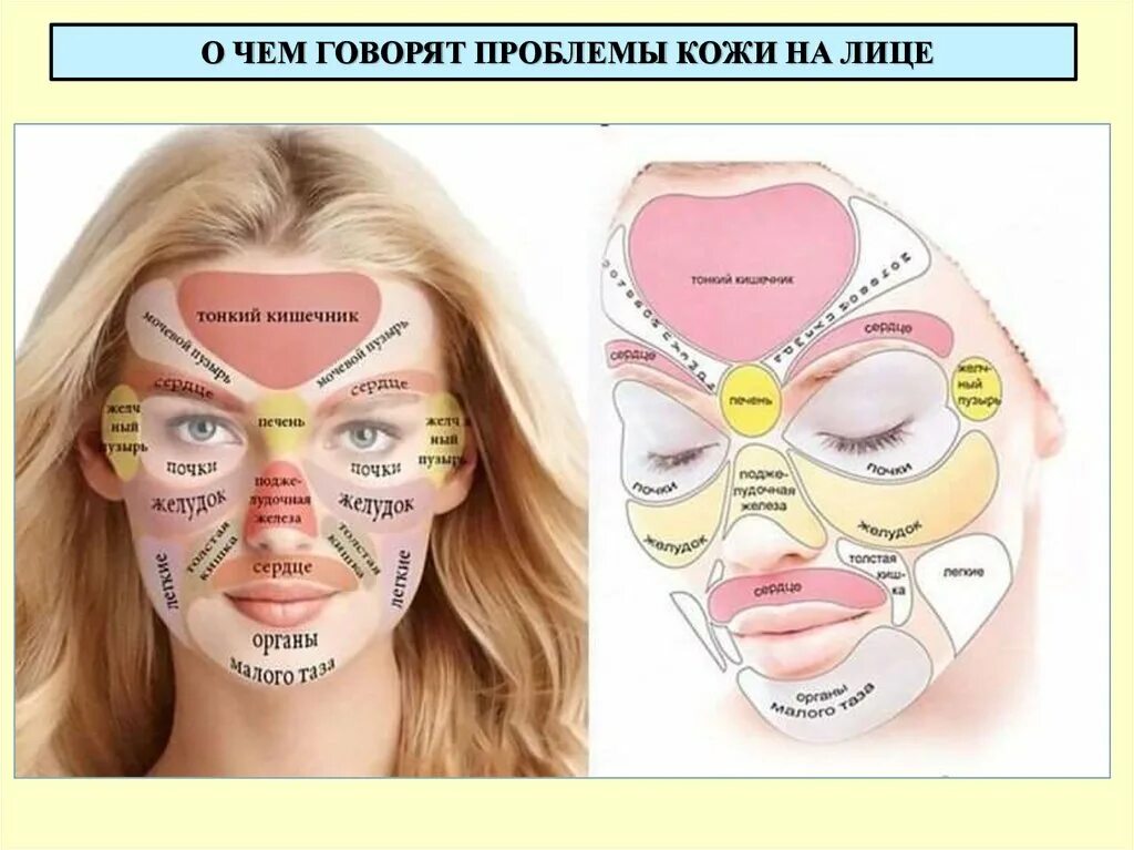 Прыщи на лбу какой орган у женщин. Карта прыщей на лице. Зоны появления прыщей. Прыщи на лице схема органов.