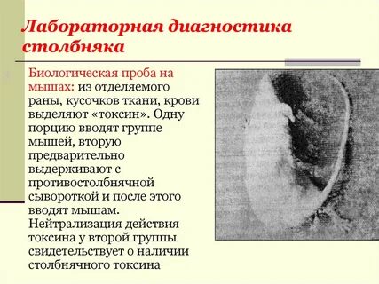 Симптомы столбняка после раны