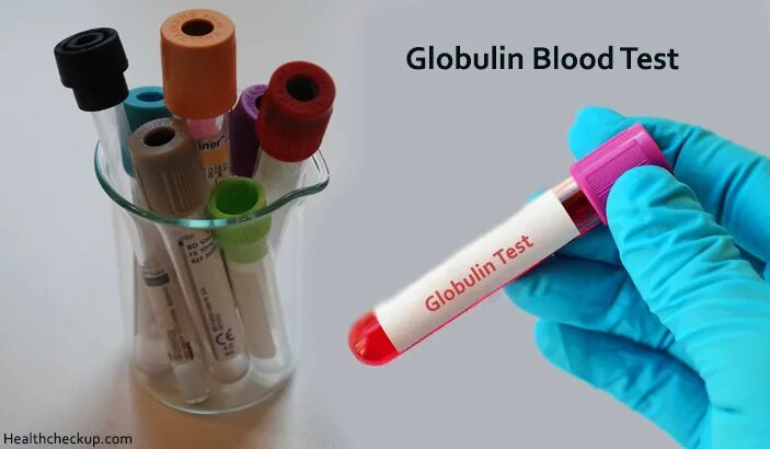 B глобулин. Globulins. Antigemofilin a-Globulini. Glabulin MCHJ IDM muftoxiddinfarm" MCH,IDM glabulin.