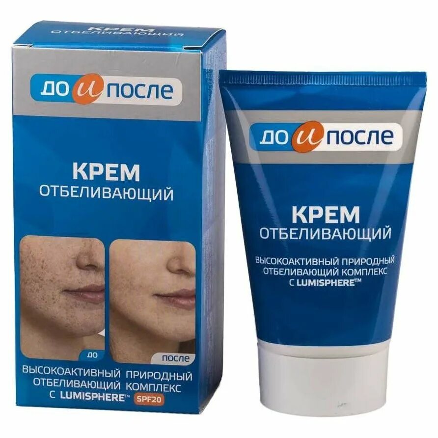 Хороший отбеливающий крем отзывы. Хороший отбеливающий крем отзывы. Хороший отбеливающий крем отзывы. Отбеливающий крем для лица от пигментных. Отбеливающий крем для лица ночной.