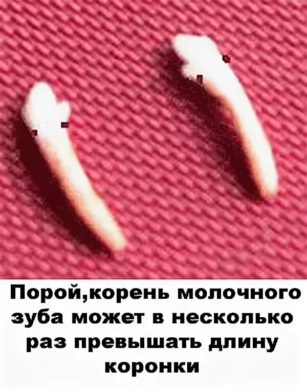 Может ли вырасти выпавший зуб. Корень выпавшего молочного зуба.