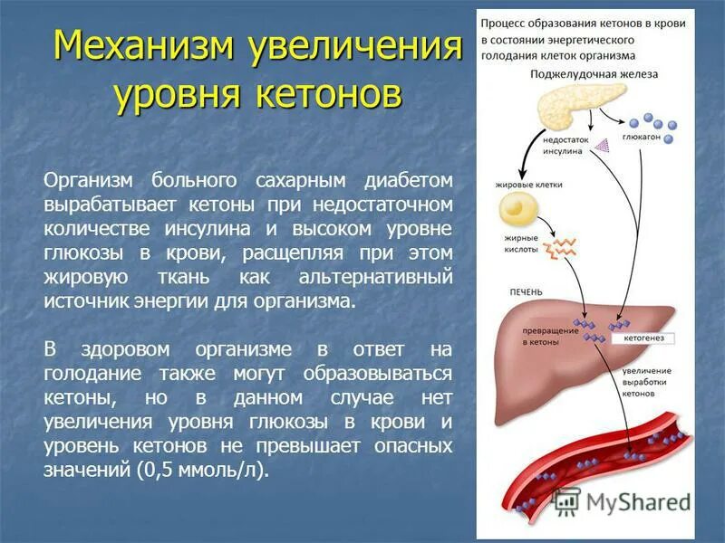 Недостаток синтеза инсулина. Кетоновые тела при сахарном диабете 1 типа. Механизм повышения уровня Глюкозы в крови при сахарном диабете. Сахарный диабет кетоновые тела. Кетоновые тела при сахарном диа.