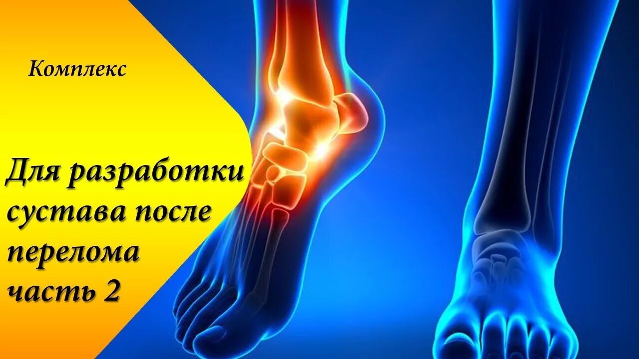 Как быстрее восстановить перелом. Как восстановить голеностоп. восстановление после перелома голеностопа. тейпирование голеностопа после перелома лодыжки. тейпирование голеностопа после перелома.