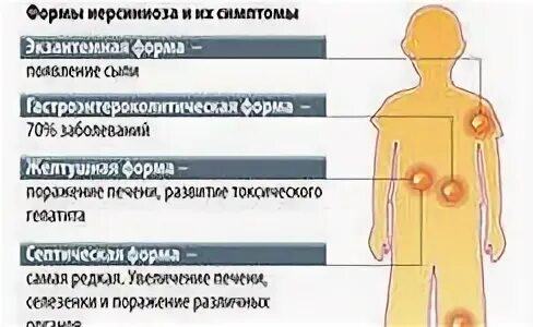 Желудочный грипп лечение у взрослых. Кишечный грипп симптомы. Кишечный грипп симптомы у детей. Признаки кишечного гриппа. Кишечный грипп симптомы у взрослых.