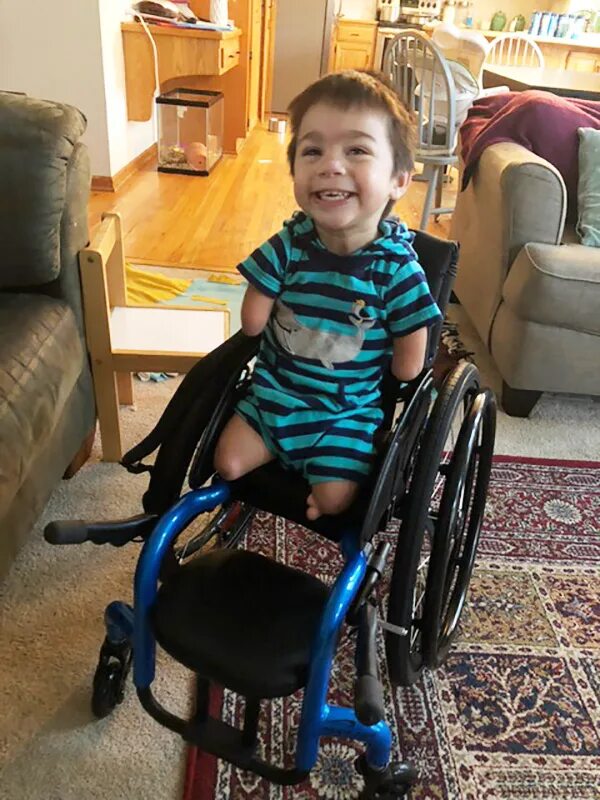 Инвалидность ребенку дцп. Ник фьючич инвалидная каляска. Дети с ДЦП. Инвалид без рук без ног.