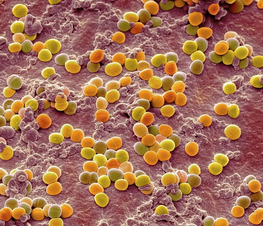 Staphylococcus aureus 3