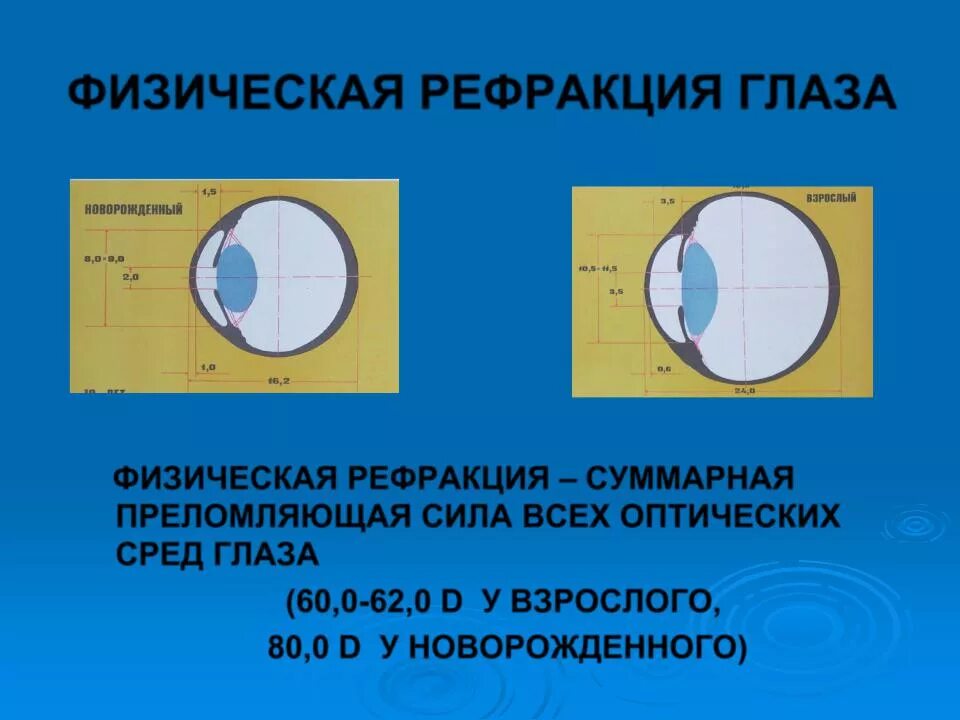 Физическая и клиническая рефракция глаза. Физическая рефракция глаза. Нарушение рефракции глаза. Физическая рефракция глаза, клиническая рефракция..