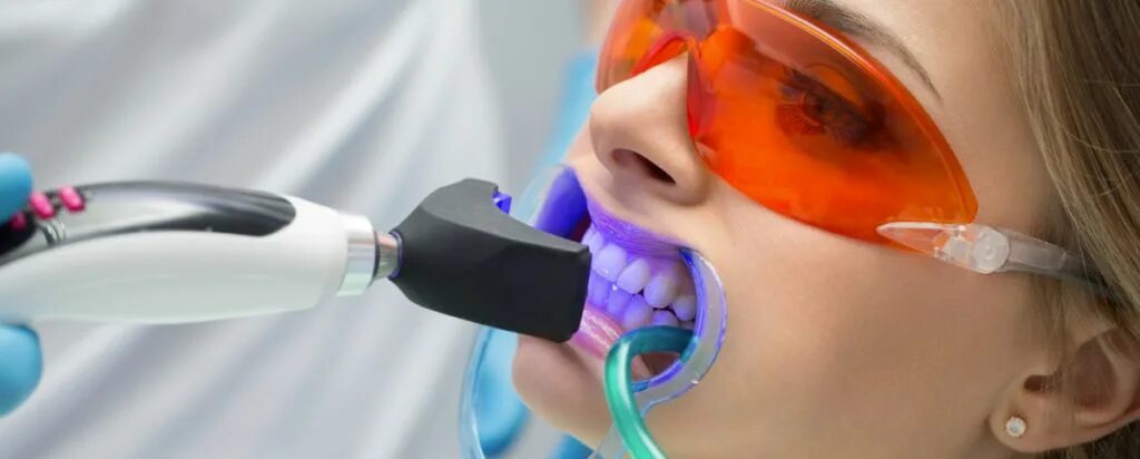 Ламповое отбеливание. Ламповое отбеливание. Отбеливание бейонд. Ламповое отбеливание. Ламповое отбеливание.