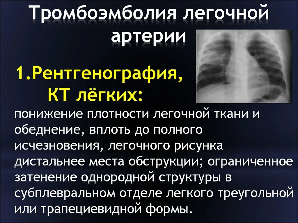 Тромболегочная эмболия. Рентгенологический синдром тромбоэмболии легочной артерии:. Тромбоэмболия лёгочной артерии симптомы рентген. Клинический признак тромбоэмболии легочной артерии. Тромбоэболиялегосной артерии.