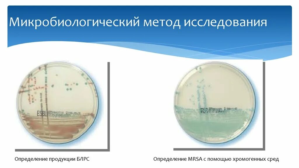 Микробиологический метод микробиология. Микробиологический метод исследования. методы исследования в микробиологии. методы исследования в микробиологической лаборатории. микробиологические методы исследования в микробиологии.