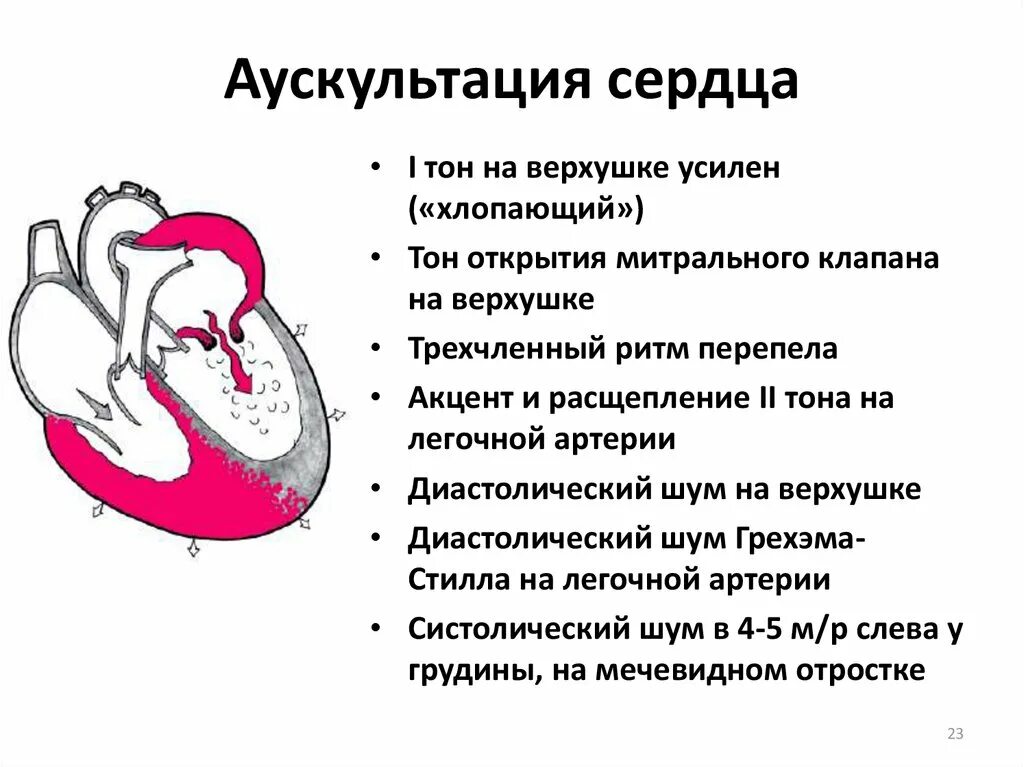 Сердечный стеноз. Стеноз митрального клапана выслушивание. Аускультация при пороках клапанов. Аускультативный признак митрального стеноза. Недостаточность аортального клапана аускультация.