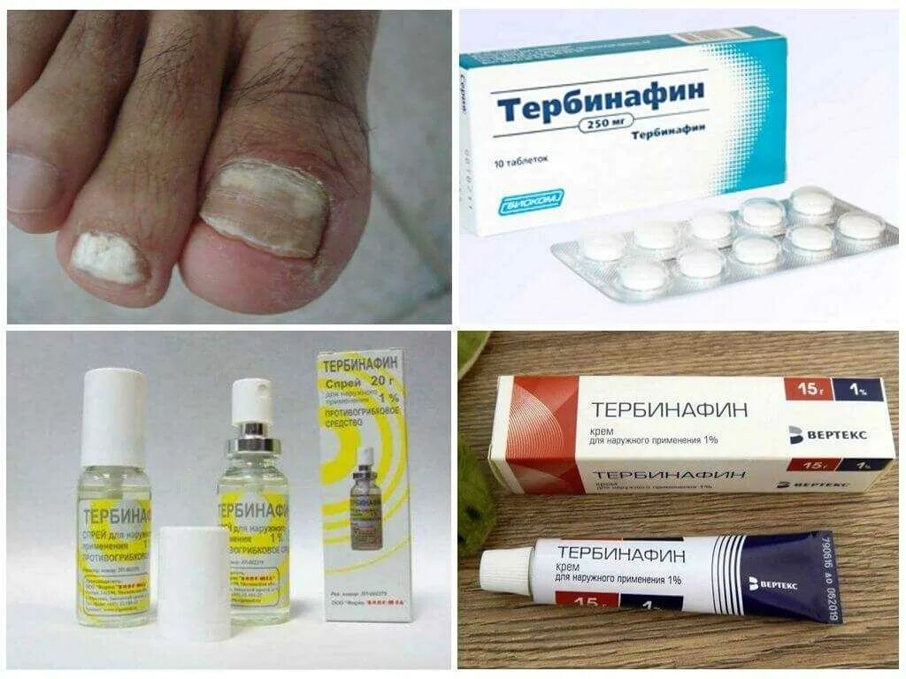 Фонгодерил от грибка. Противогрибковый лак. таблетки и мазь от грибка ногтей на ногах тербинафин. экзодерил лак от грибка. таблетки против грибка ногтей на ногах тербинафин.