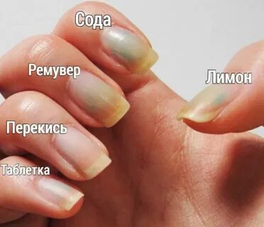 Почему желтеют ногти причина