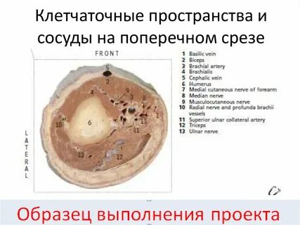 Срезы произведение