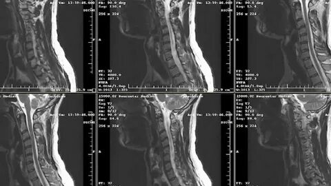 Xray client