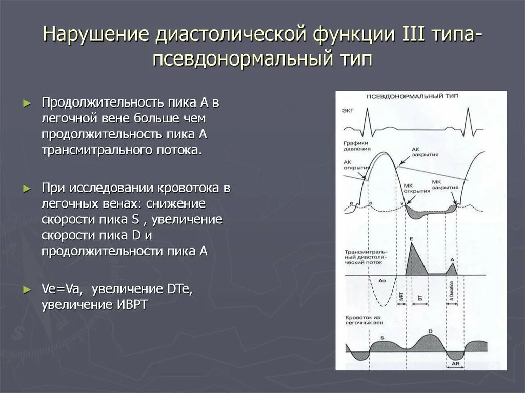 Диастолический понижен. Типы нарушения диастолической функции лж. Оценка диастолической функции лж. Диастолическая дисфункция левого желудочка на ЭХОКГ. Эхокардиография диастолическая дисфункция по 1 типу.