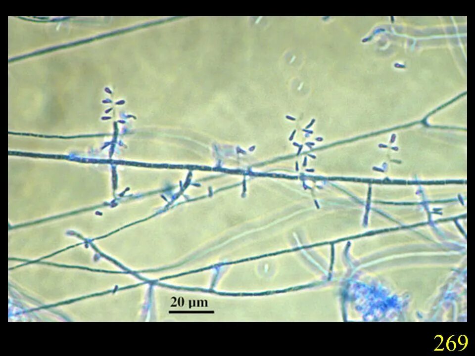 мицелий грибов в моче микроскопия. мицелий актиномицетов микроскопия. Candida albicans мицелий. мицелий микроскопия. мицелий грибов микроскопия.